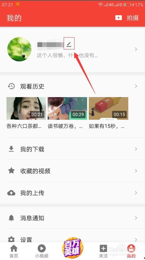吃瓜昵称搞笑视频大全集,让你笑到肚子疼